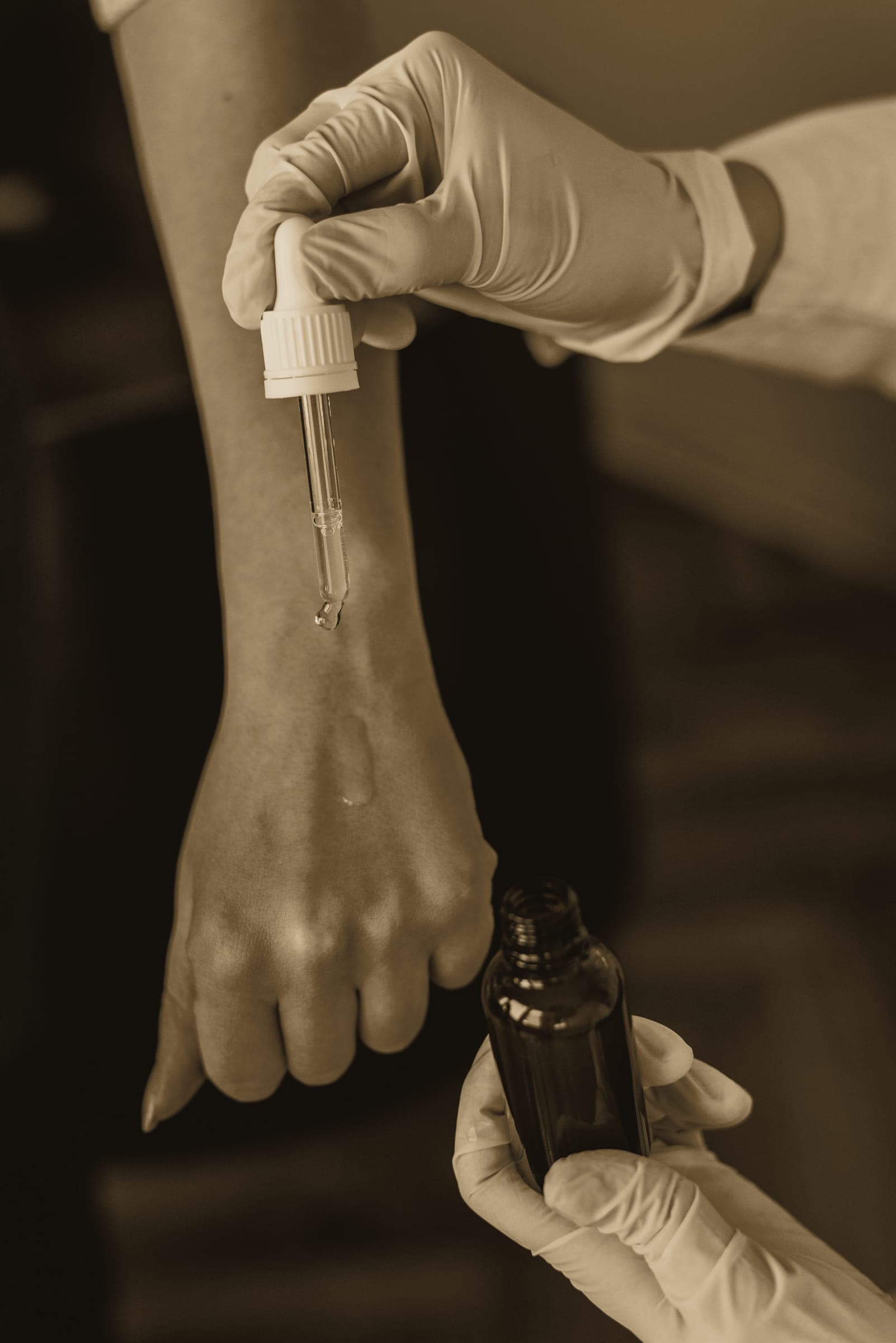 Gloved hands holding an amber dropper bottle over a patient's forearm.